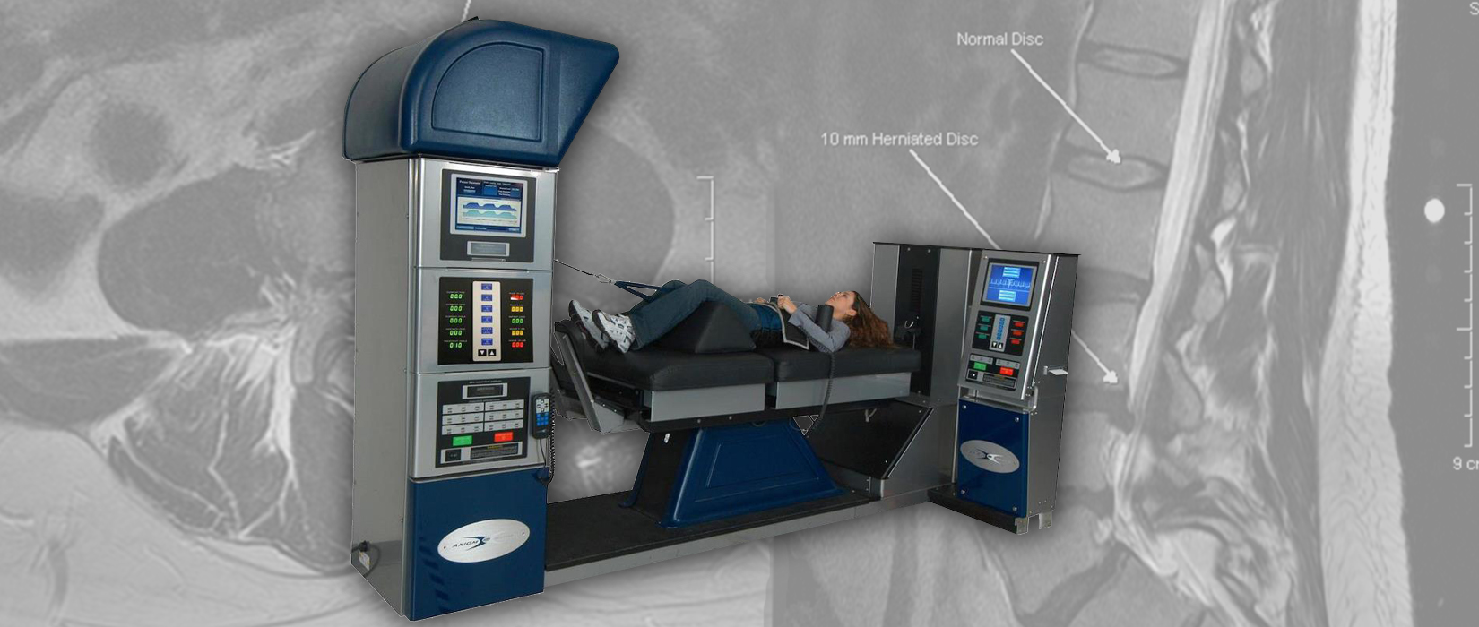 Spinal Decompression in Yorba Linda - Prieto Chiropractic